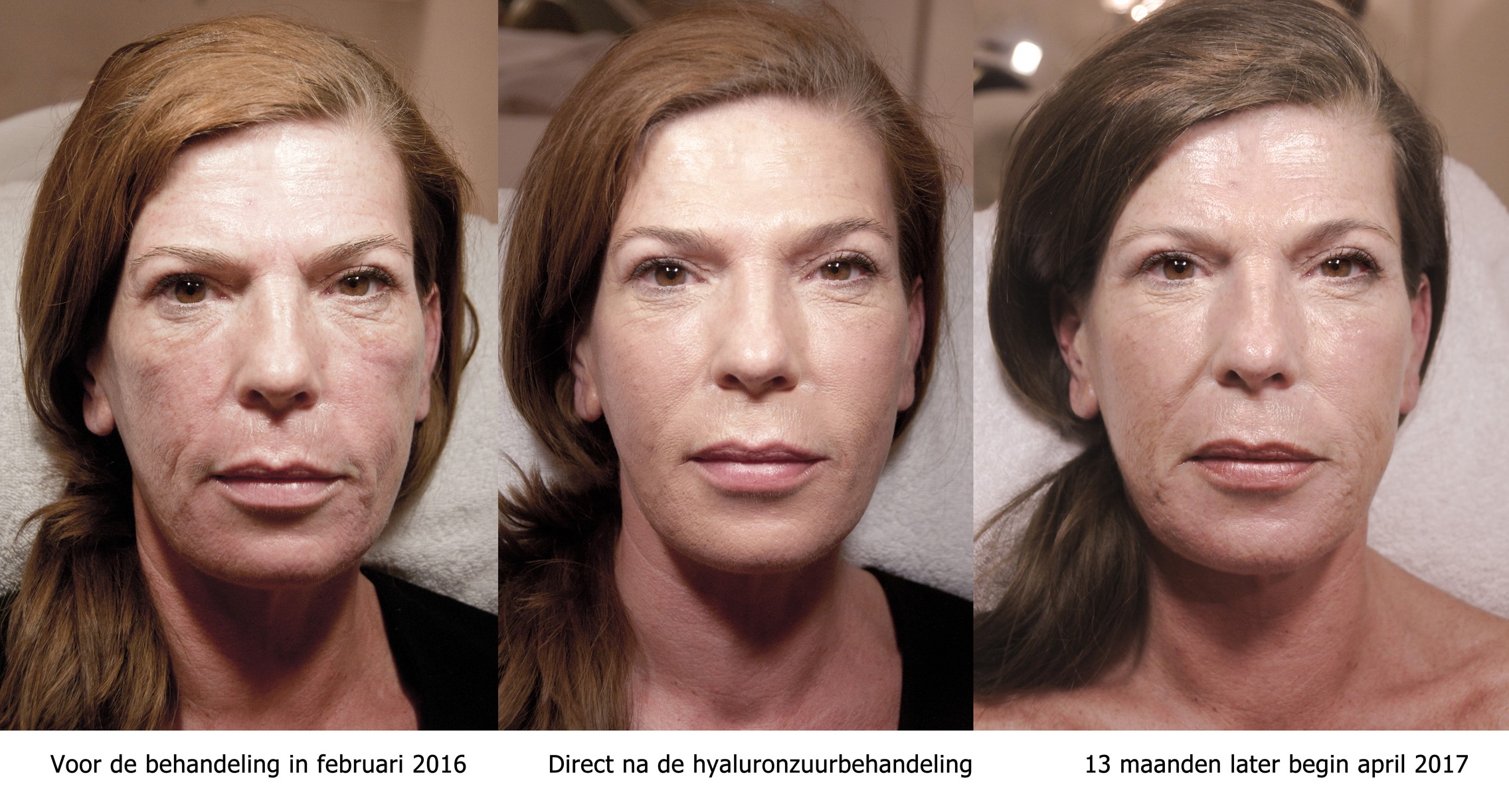 Klant Aan Het Woord Nadine Gregoire