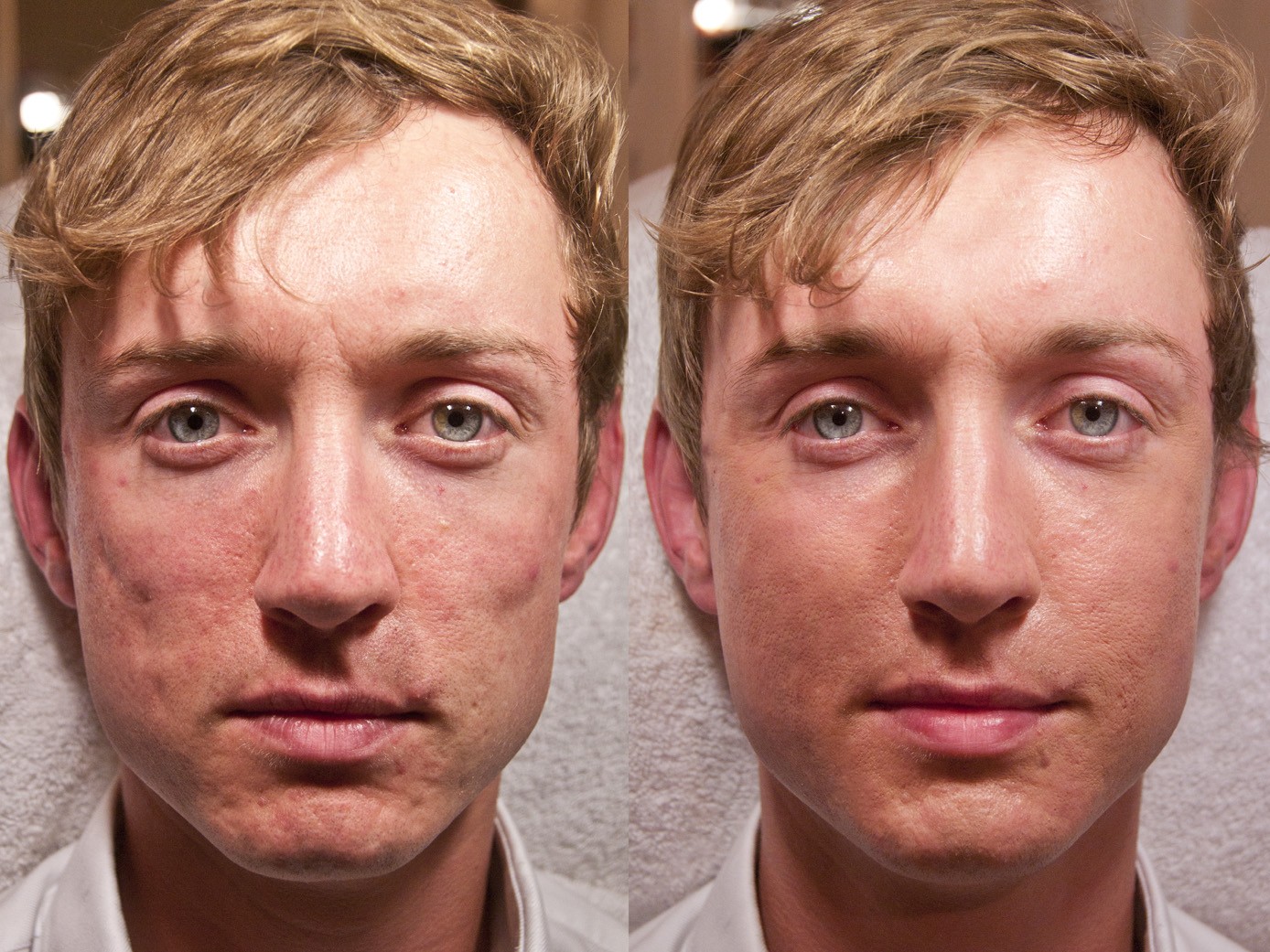 Image title Image title